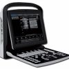 chison eco1 portable ultrasound