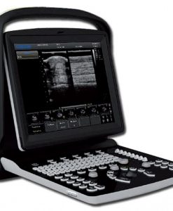 chison eco1 portable ultrasound