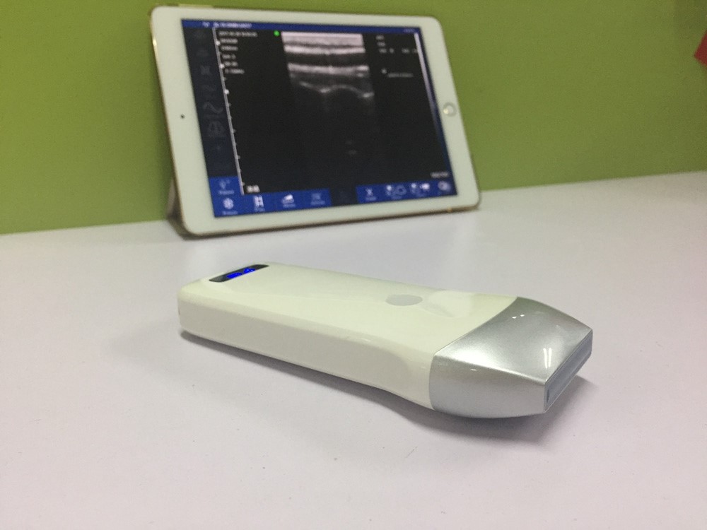 Portable ultrasound Machine & Wireless Probe for Iphone or Ipad BD