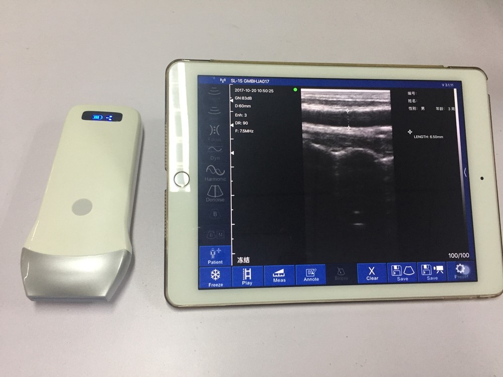 Portable ultrasound Machine & Wireless Probe for Iphone or Ipad BD