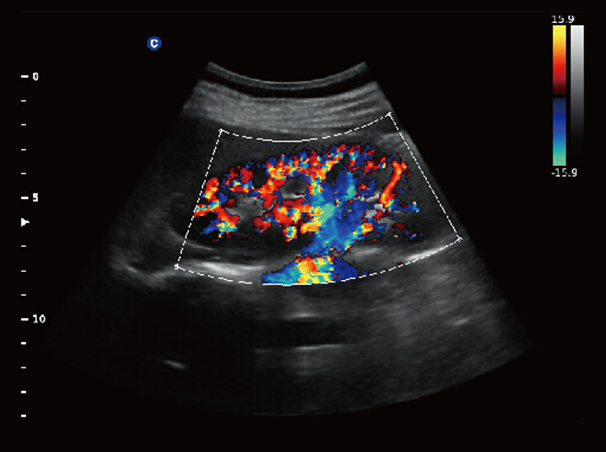 Chison QBit-3 Ultrasound Machine