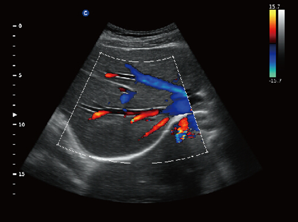 Chison QBit-3 Ultrasound Machine
