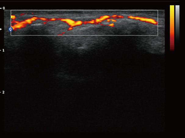 Chison QBit-3 Ultrasound Machine Chison QBit-3 Ultrasound Machine