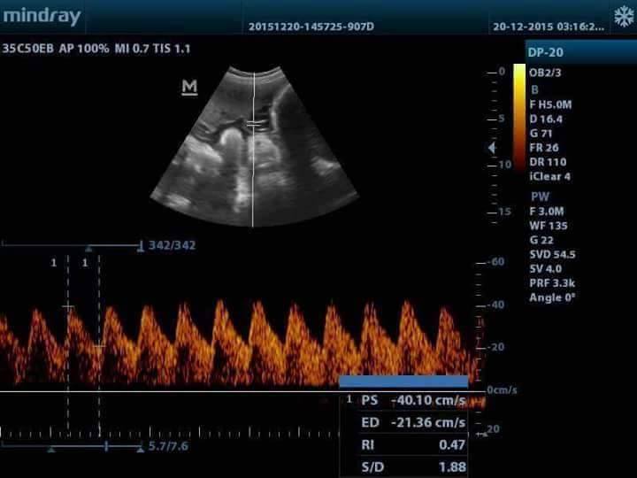 MINDRAY DP-20 Ultrasound Machine - Image 4
