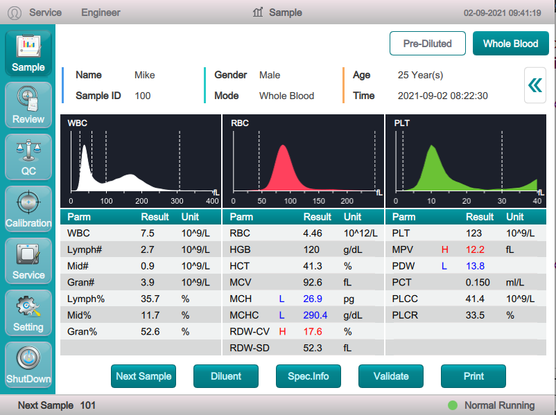 Bio Elab EC-38 Automated 3 Part Hematology Analyzer - Image 4