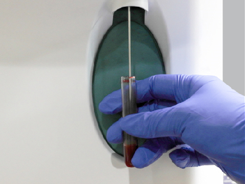 Bio Elab EC-38 Automated 3 Part Hematology Analyzer - Image 3