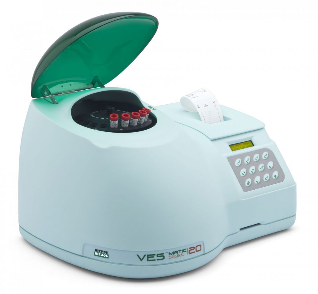Auto ESR Analyzer Ves Matic-20 - Image 2