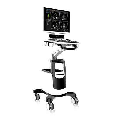 Chison QBit-7 4D Color Doppler Ultrasound - Image 4