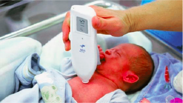 Neonatal Handheld Rapid bilirubin jaundice Test Meter - Image 4