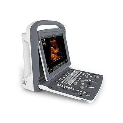 CHISON ECO-2 Color Digital Ultrasound Machine - Image 3