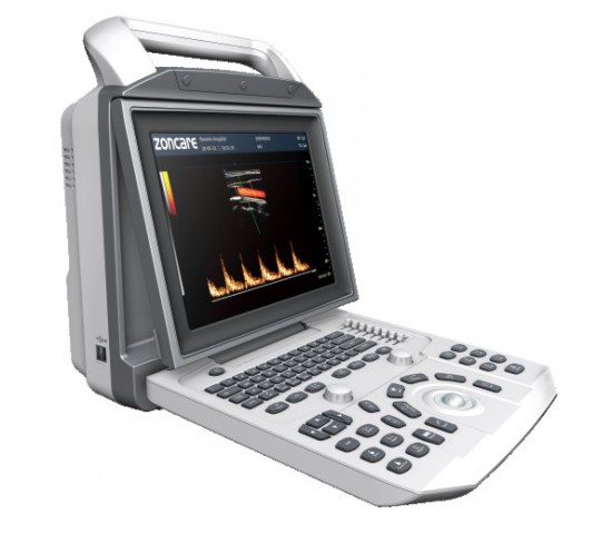 Zoncare-i50 Color Portable Ultrasound Machine - Image 2