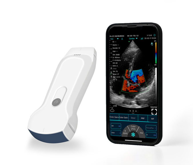 Dual-Probes Multipurpose Wireless Ultrasound - Convex + linear + Cardiac Probe