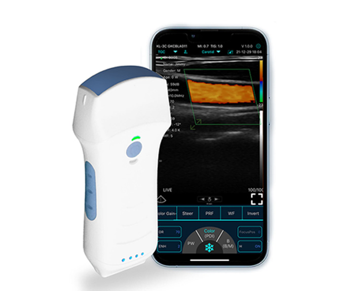 Dual-Probes Multipurpose Wireless Ultrasound - Convex + linear + Cardiac Probe - Image 5