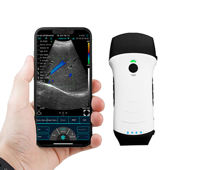 Dual-Probes Multipurpose Wireless Ultrasound - Convex + linear + Cardiac Probe - Image 4