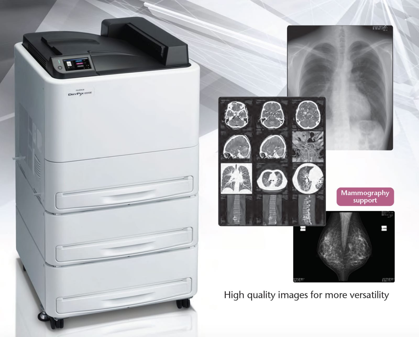 Fujifilm DryPix EDGE – High-Speed Diagnostic Printing - Image 2