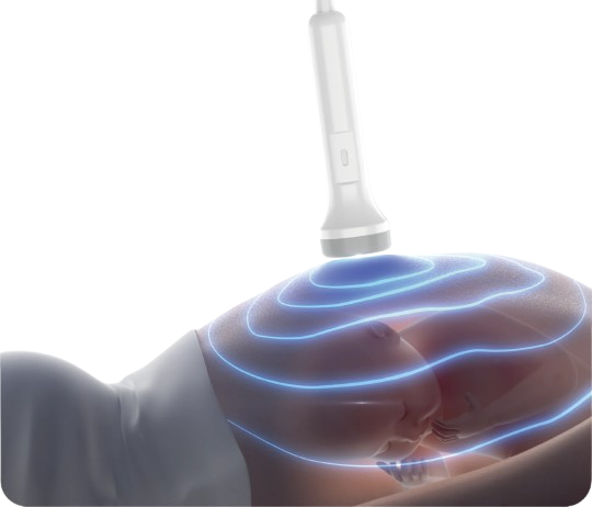 Jumper JPD-100F Fetal Doppler