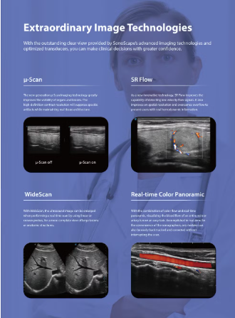 SonoScape P9 Elite Ultrasound Machine