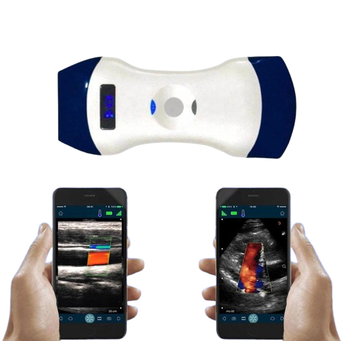 SonoSmart Double heads Wireless ultrasound Probe
