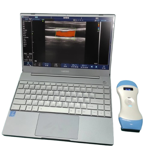 SonoSmart Double Heads Wireless Ultrasound Probe