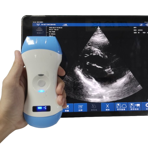 SonoSmart Double heads Wireless ultrasound Probe