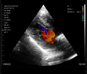 SonoSmart Double heads Wireless ultrasound Probe
