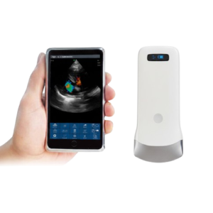 SonoSmart Linear-16C Wireless Ultrasound Probe