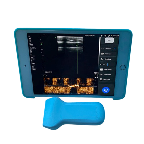 SonoSmart Linear-16D Wireless Ultrasound Probe
