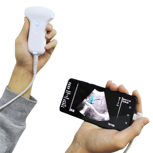 SonoSmart Linear-16D Wireless Ultrasound Probe