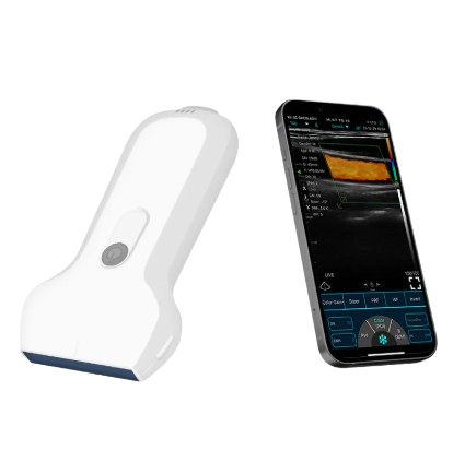 SonoSmart Linear-16D Wireless Ultrasound Probe