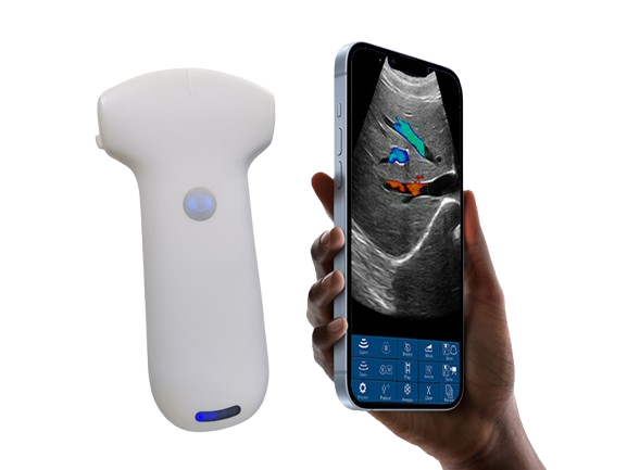SonoSmart Wireless Ultrasound Probe