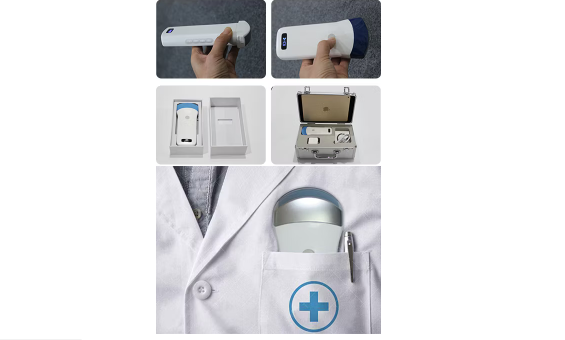 Sonostar Convex Probe