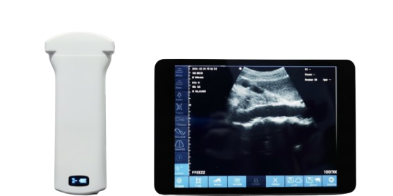 Wireless ultrasound probe price in Bangladesh