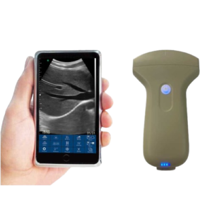 Mini Probe Type Palm Ultrasound Scanner