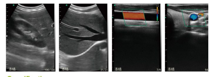Mini Probe type palm Ultrasound Scanner