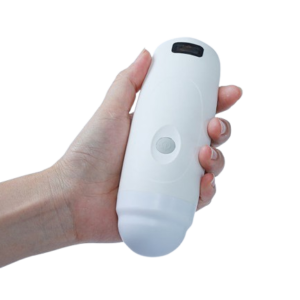 SonoSmart 4D Bladder Wireless Ultrasound Probe