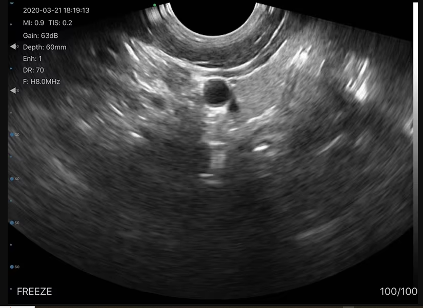 SonoSmart Phased Array Wireless Ultrasound Probe