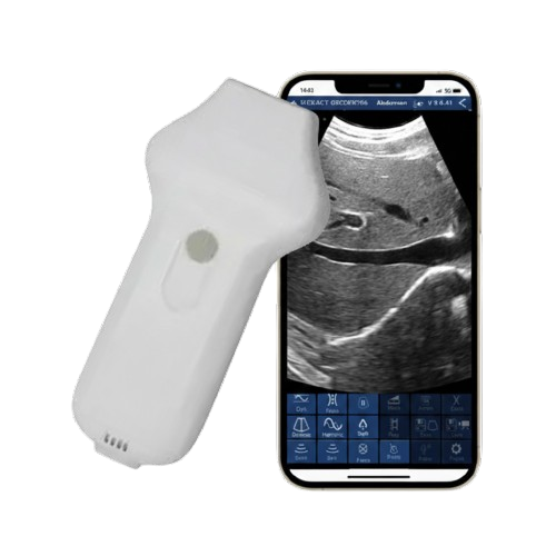 SonoSmart Phased Array Wireless Ultrasound Probe