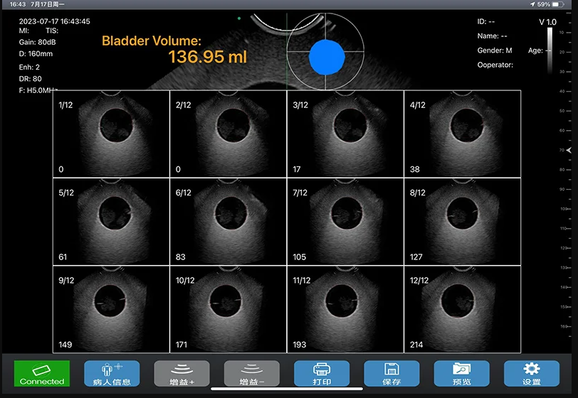 Ultrasound Probe WIFI Connected