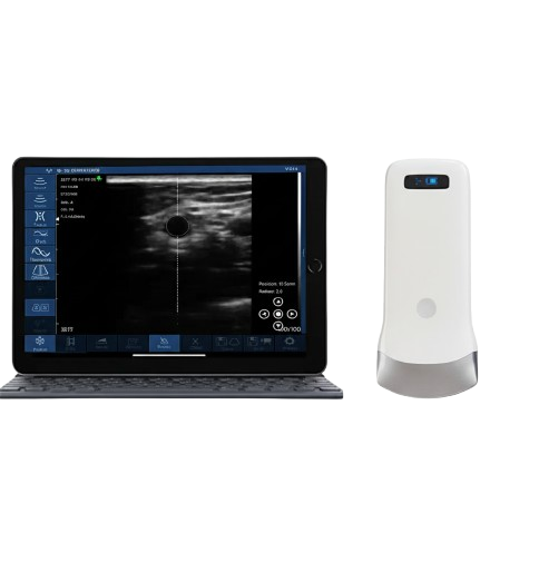 Wireless Probe Ultrasound Scanne