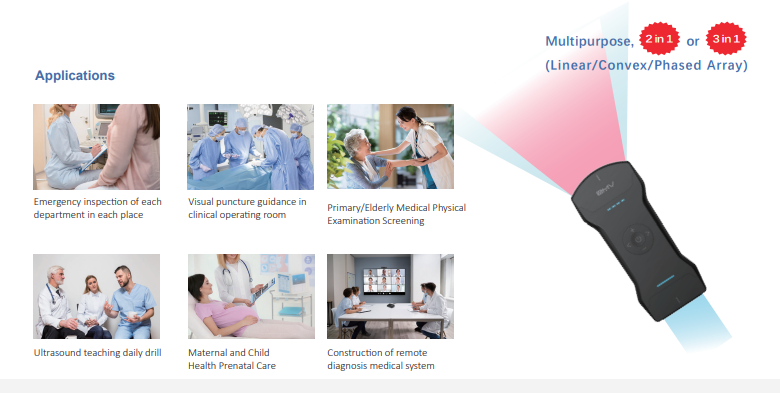 Wireless Ultrasound Imaging System.