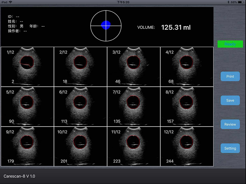 Wireless Ultrasound Probe