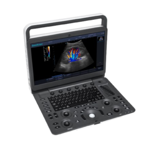 SonoScape E2 Color Doppler Ultrasound