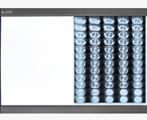 Flmplent Double ZG-2D LED X-Ray Film Viewbox